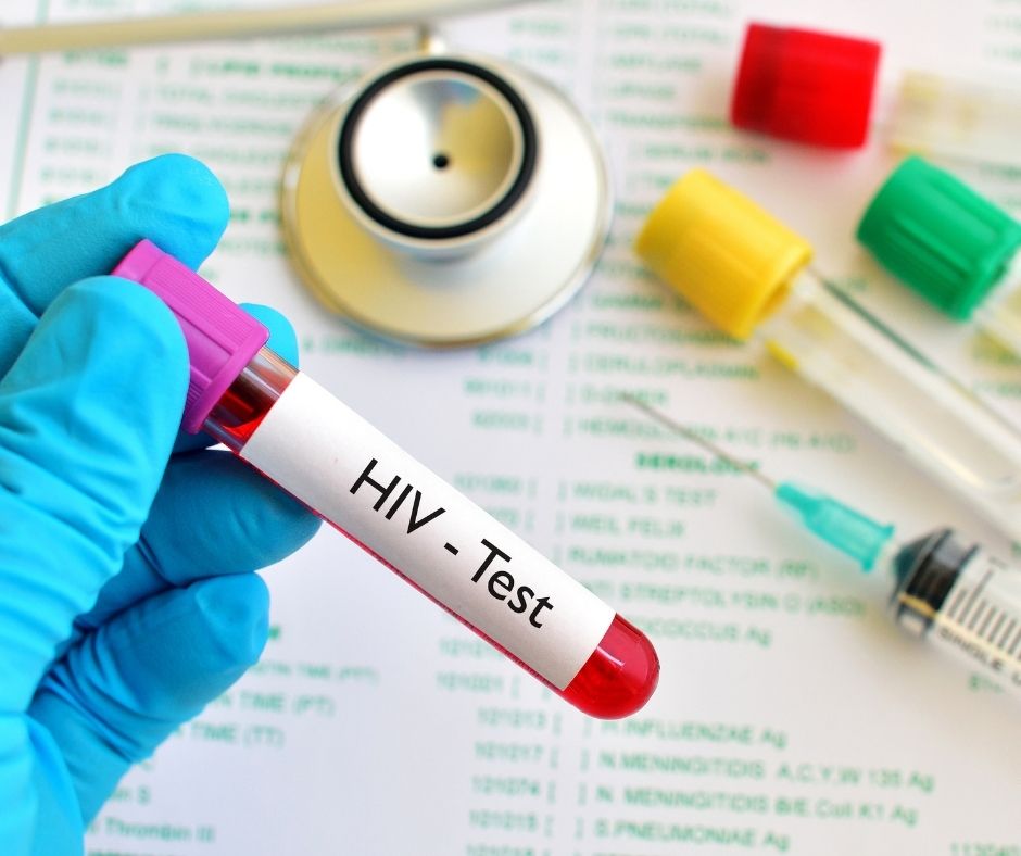 HIV TEST