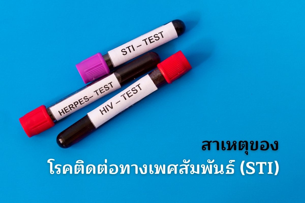 สาเหตุของโรคติดต่อทางเพศสัมพันธ์