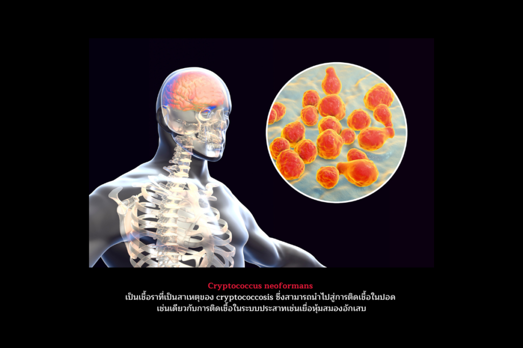 Cryptococcus neoformans