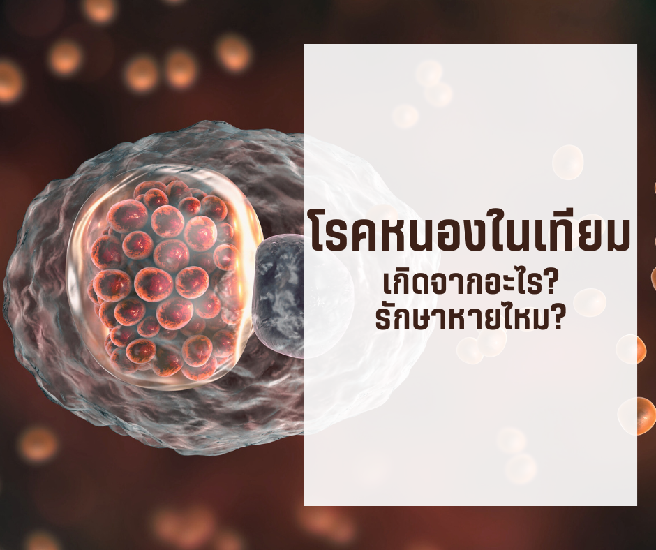 โรคหนองในเทียม เกิดจากอะไร รักษาหายไหม