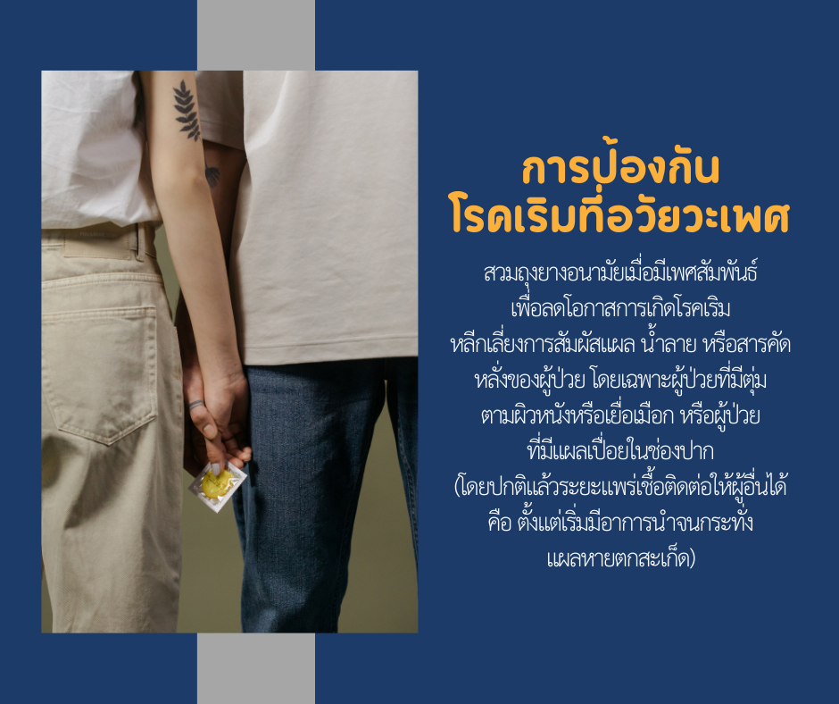 การป้องกันโรคเริมที่อวัยวะเพศ