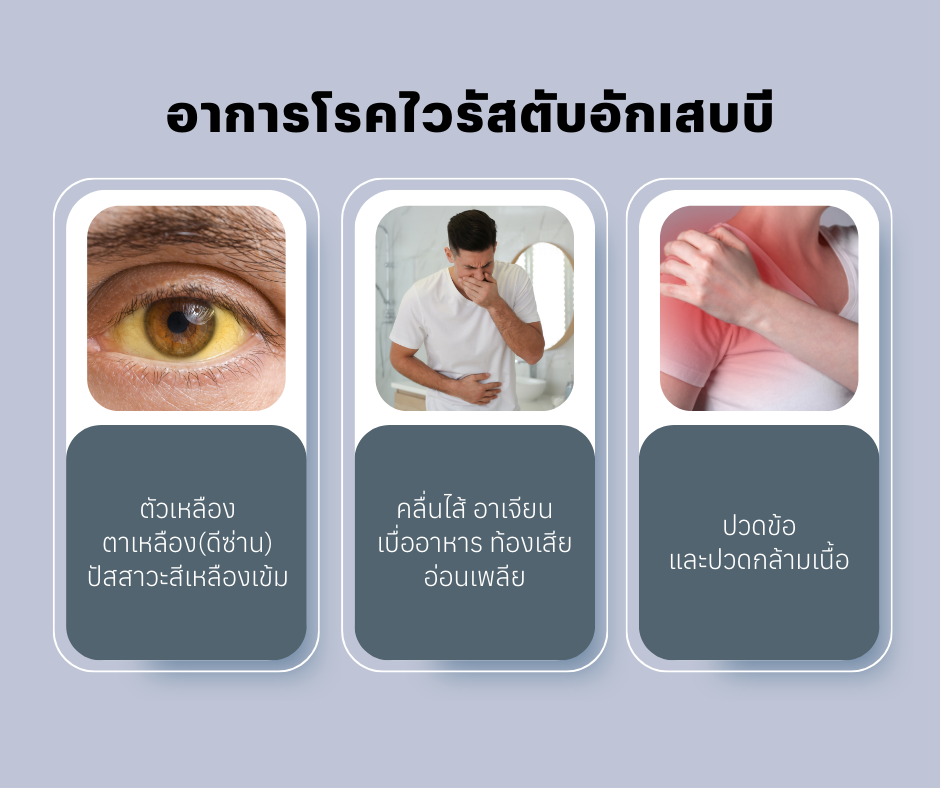 อาการโรคไวรัสตับอักเสบบี