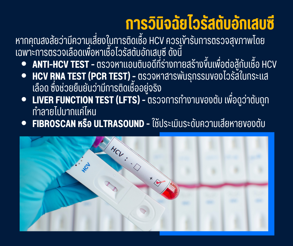 การวินิจฉัย ไวรัสตับอักเสบซี